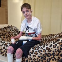 UPDATE 29.07.2025 – Daniel are nevoie de noi – Sprijin pentru intervenții și recuperare